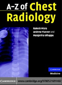 A-Z for Chest Radiology,2007