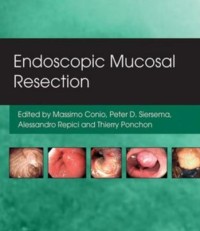 Endoscopic Mucosal Resection