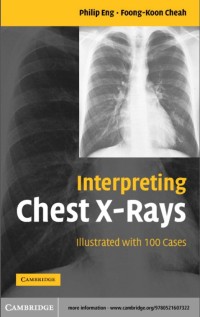 INTERPRETING CHEST X-RAYS: Illustrated with 100 cases