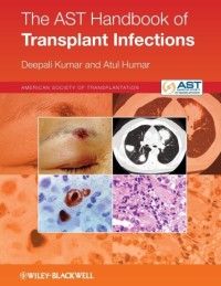 The AST Handbooks of Transplant Infections