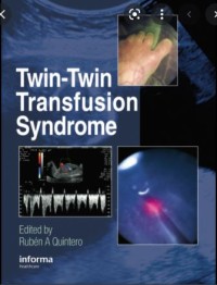 Twin–Twin Tranfusion Syndrome