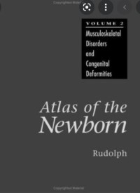 Atlas of The Newborn: Musculoskeletal Disorders
and Congenital Deformities