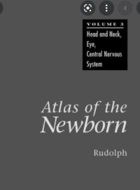 Atlas of The Newborn: Head and Neck, Eye, Central Nervous System